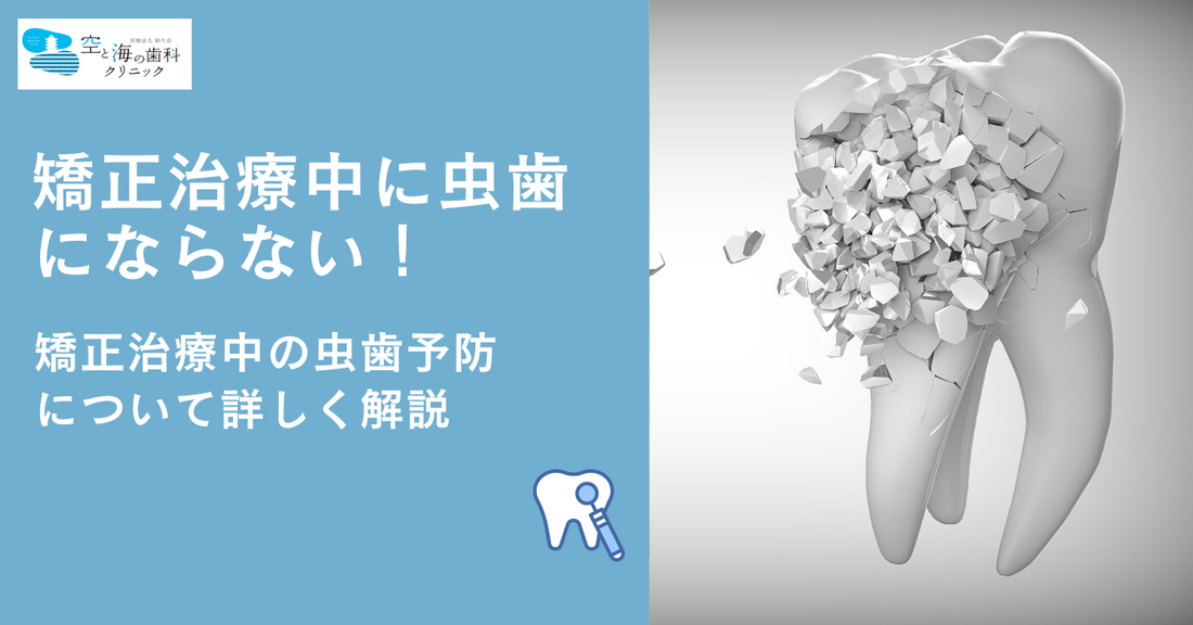 矯正治療中に虫歯にならない！ 矯正治療中の虫歯予防について詳しく解説